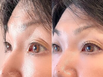 チェリッシュ(Cherish)/フラットラッシュ