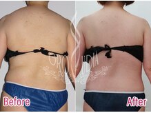 グラウディア 恵比寿/痩身/筋膜リリース/インディバ超