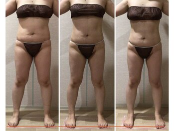 エステティックサロン フェアリー(ESTHETIC SALON FAIRLY)/痩身＊美BODYは1日にしてならず