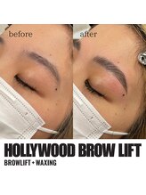 ルアナ(LUANA)/ハリウッドブロウリフト