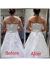 フェリーチェ(felice)/ブライダル痩身エステ