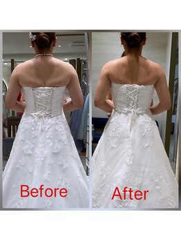 フェリーチェ(felice)/ブライダル痩身エステ