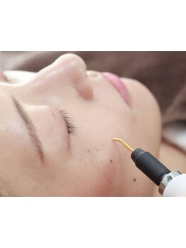 シミしわ改善！予防ケア