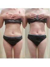 マイフェアレディ 今池(MyFairLady)/【人気No1】ラフォス&マッサージ