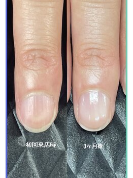 クーラ アンド ベリッシモ(Cura&Bellissimo)/お爪の形は変わります