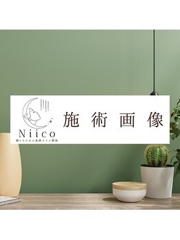 ニーコ 新宿御苑前(Niico)/施術画像