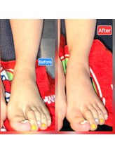 足つぼまーさん/色、形　温度がすぐ変わります！