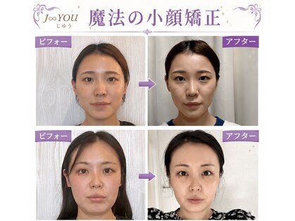 じゆう(J∞YOU)の写真