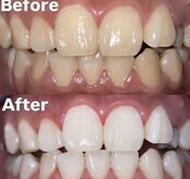 ホワイトニングビューティー 光の森店(WHITENING BEAUTY)