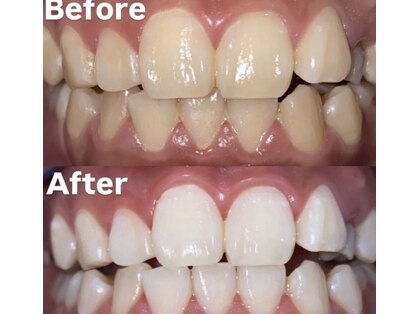 ホワイトニングビューティー 光の森店(WHITENING BEAUTY)の写真