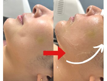 ビューイング(美ing)/人気No1☆肌力upノーファンデ肌