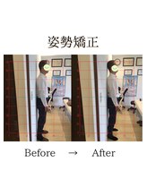 心斎橋長堀フェムテック整骨院/11姿勢矯正　骨格矯正と骨盤矯正