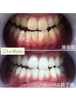 ルブラン 奈良店(Le Blanc)/歯のお手入れしてますか??