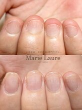 マリーロール 梅田店(Marie Laure)/深爪矯正/自爪育成/自爪風