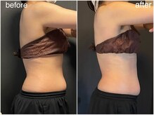 ミミ(MIMI)/【ダイエット】上半身集中