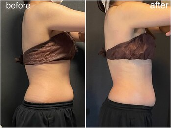 ミミ(MIMI)/【ダイエット】上半身集中