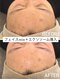 ネオファースト 大阪福島店(NeoFirst)の写真/【憧れの韓国ツヤ肌に♪】スキンケアの浸透率も格段にUP《艶肌フェイスワックス＆エレクトロポレーション》
