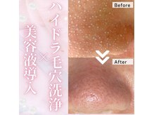 ザ ピーチ(THE PEACH)の雰囲気（SNSで大人気のハイドラ毛穴洗浄◎お手頃価格で受けられます）
