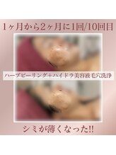 GRACETHOUSAND(グレイスサウザンド)/ハーブピーリング/洗浄/シミケア