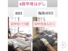 六花(リッカ)/大人気の肩甲骨剥がし