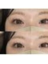 バニーアイズ 天神(Bunny eyes TENJIN)/パリジェンヌラッシュリフト