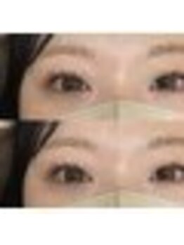 バニーアイズ 天神(Bunny eyes TENJIN)/パリジェンヌラッシュリフト