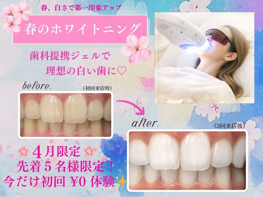 期間限定‼値下げ‼美歯口✨セルフホワイトニング 美歯口ホワイトニング（セルフホワイトニング機器）CWB（ブラック