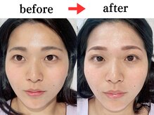 ジョリー(JOLi)/眉毛ワックス×まつげパーマ