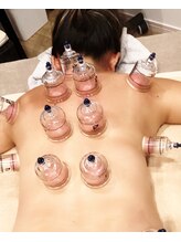 ルオラ(LUOLA)/カッピング