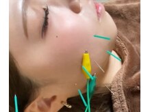 大場はりきゅう接骨院 整体院の雰囲気（■ワンランク上の美肌ケア■美容鍼■今までのお顔のお悩み改善♪）