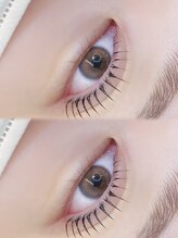 ピュア(PURE)/あなたの瞳に輝きを。