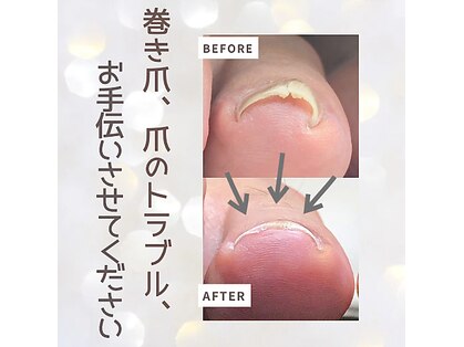 ネイルサロン キリグ(KILIG)の写真