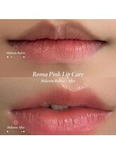 ヨウン 大阪心斎橋(yeoun)/ローマピンク大阪/メラニンケア