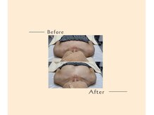 オベリオ(OBERIO)/