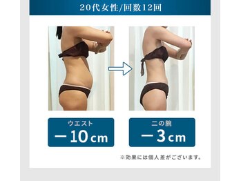 シュリット(Schritt.)/筋肉マシーン(お腹)