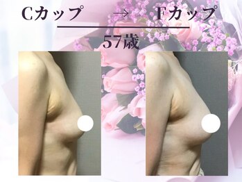 Ms.やまとなでしこ 明石店/ビフォーアフター