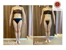 サンニロク(326)の雰囲気(短期ブライダルエステもお任せください◎)