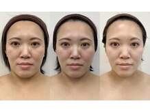 このはな(KONOHANA)