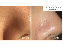 シリウス(Sirius)/3つの美容液で洗浄+潤いを