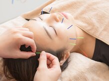 骨盤スタイル鍼灸整骨院 鹿島田院/美容鍼＆ヘッドスパ