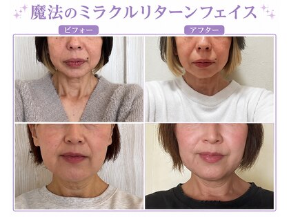 じゆう(J∞YOU)の写真