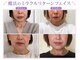 じゆう(J∞YOU)の写真