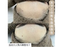 カルディエ(Cardie)の雰囲気（【最新のTHR脱毛導入】隅々まで丁寧施術◎幅広い毛に効果抜群!）