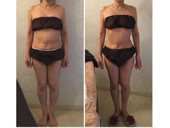 ボディメイクサロン ブリエ(briller)/筋膜1回★くびれも◎