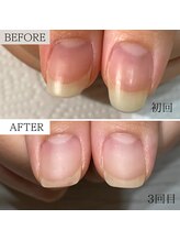 ビエル(BIeL)/京都自爪育成　フィルイン