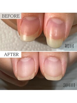 ビエル(BIeL)/京都自爪育成 フィルイン