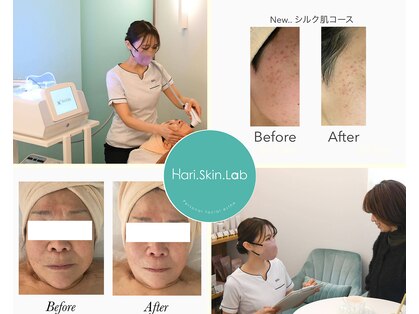 ハリスキンラボ(Hari.Skin.Lab)の写真