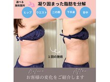 アクア(akua....)の雰囲気（1回でもご覧の通りの結果！短時間で！）