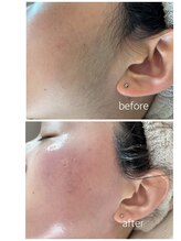 フェイス(Faith)/お顔シュガーリング