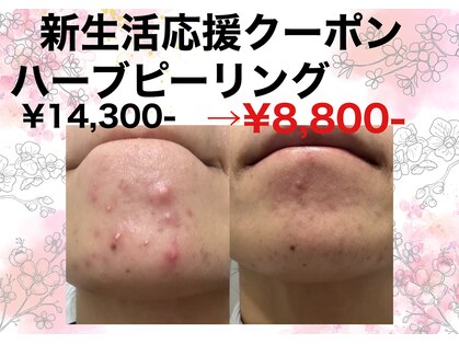 サロンツキ(salon tuki)の写真